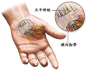 腕管综合征-常用检查方法