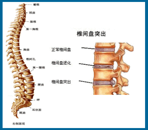 椎间盘突出为什么多发于下腰椎部位